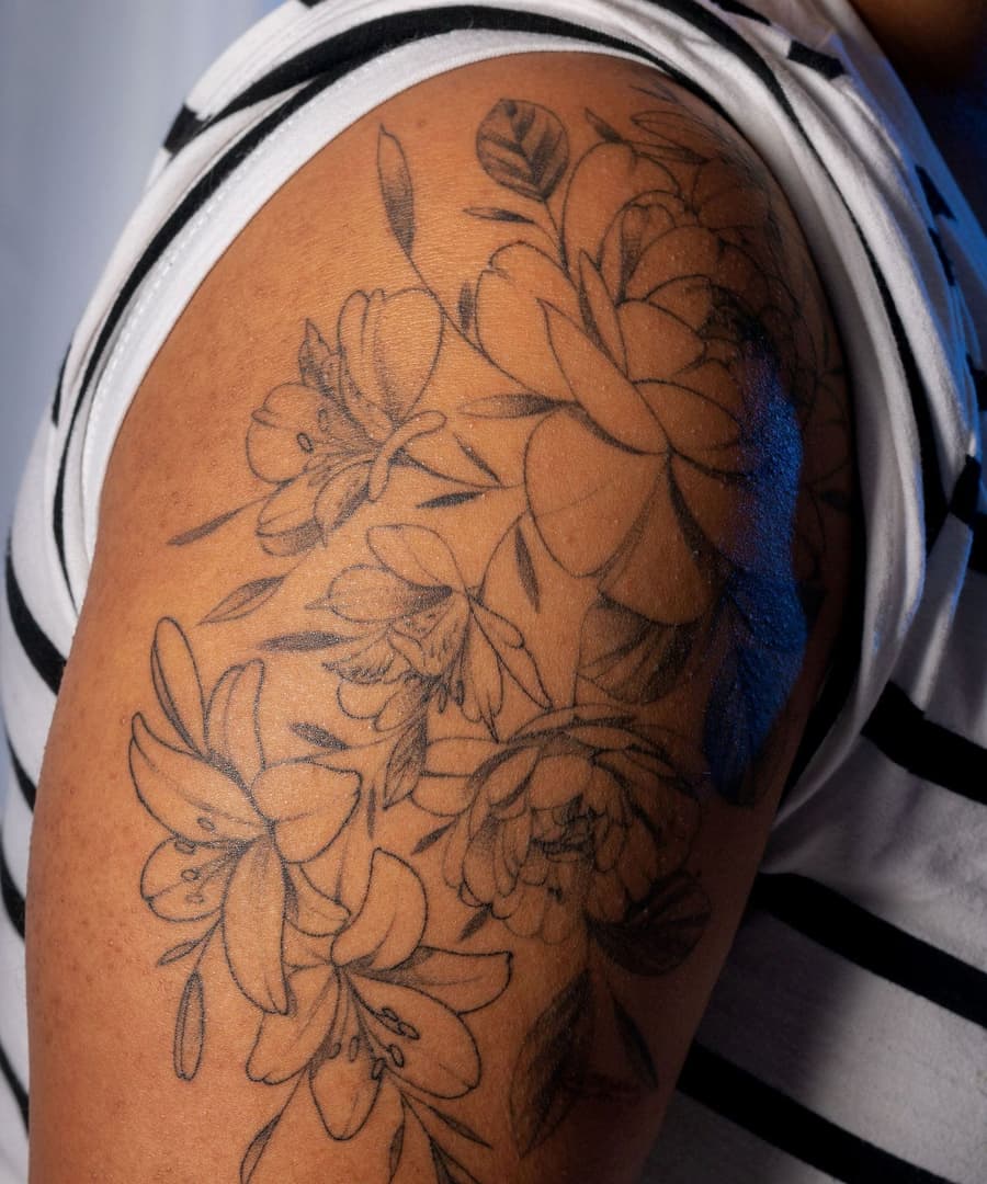 Healed fine line lilies running from a shoulder down the upper arm