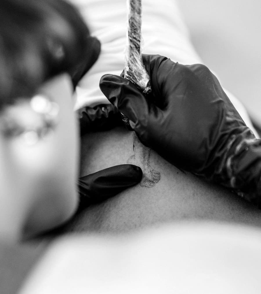Mira's gloved hand working a fine needle close to the skin